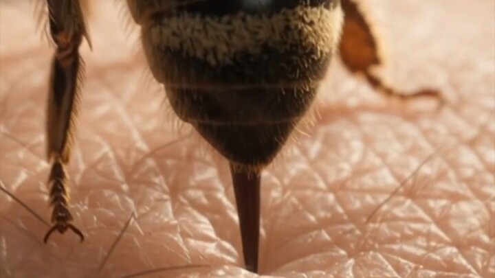 🐝🩸 What Happens When a Bee Stings You? | 3D Animation
