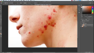 Bản chất của Frequency And Seperation