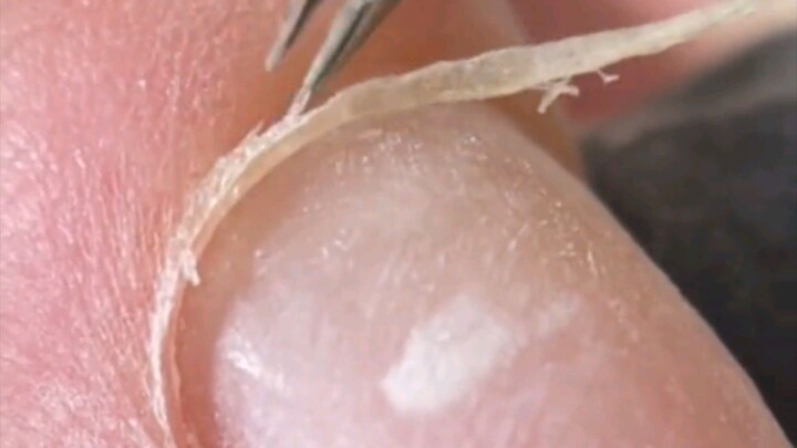 Removing cuticle and dry skin 😱😱😱♥️