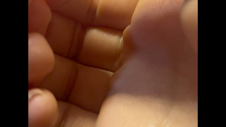 A “crispy” college student’s nail broke, so they just ripped it off.