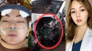 Shocking! LAGAY ni Dr.Krizzel Luna Sa OSPITAL KRITIKAL Matapos ang Car Accident!