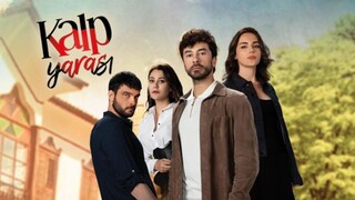 Kalp Yarasi Ep 30