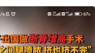 Xương gãy có tăng chiều cao không? Tôi tưởng đó chỉ là một trò đùa nhưng không ngờ lại có người thực