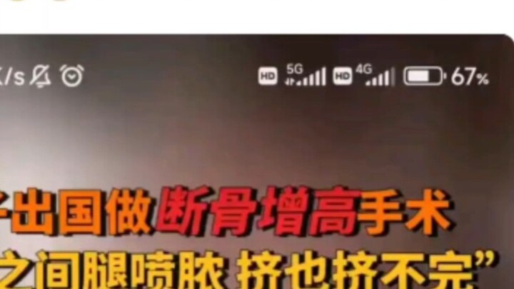 Bone breaking to increase height? I thought it was just a joke, but I didn't expect someone to actua