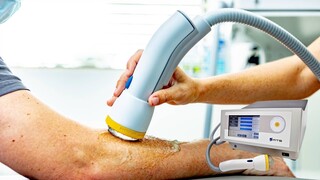 SoftWave Therapy