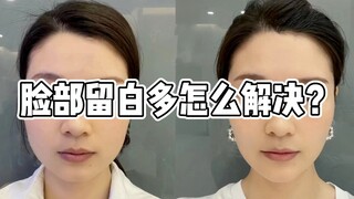 How can I deal with excessive blank space on my face?