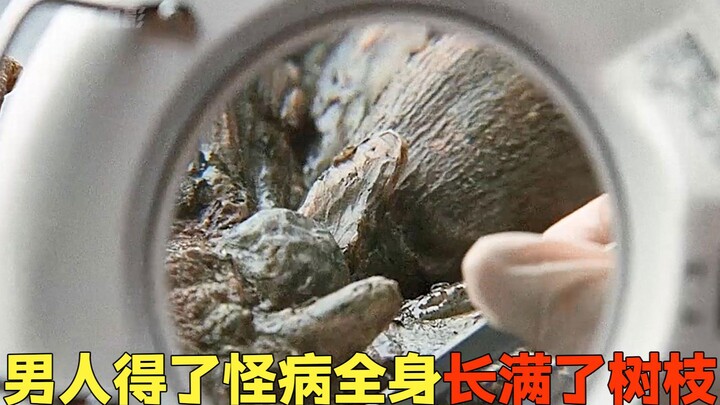 A man suffers from a strange illness, with tree branches growing all over his body.