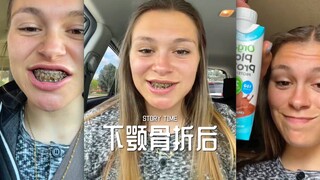 Setelah patah rahang