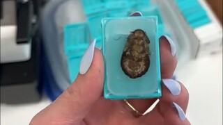 تُقطع الصراصير المعالجة إلى شرائح رقيقة باستخدام آلة التقطيع، ثم تُصبغ وتُفحص تحت المجهر... اتضح أن 