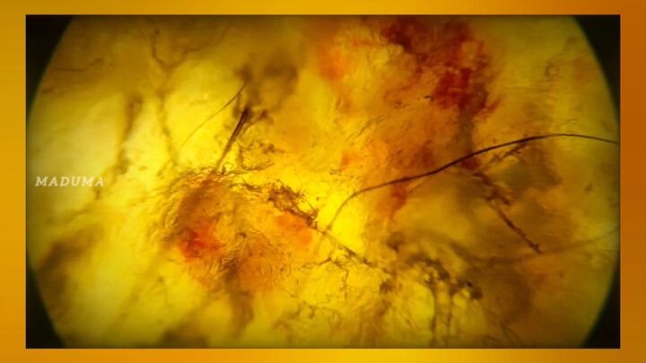 Small Wound, Big Secret