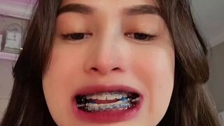 正畸能有多难受，看这个视频就大概能理解了