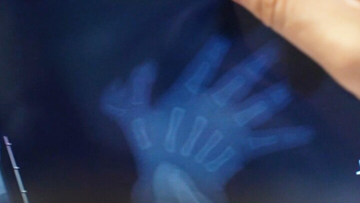 The baby has extra fingers, and the dad is also an orthopedic surgeon—so their “professional” conver