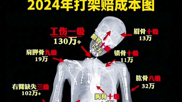 Nếu có người làm bạn ngã thì sao?