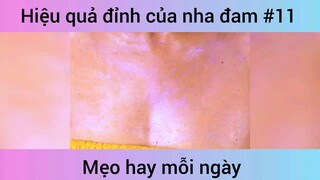 Hiệu quả đỉnh của nha đam p11
