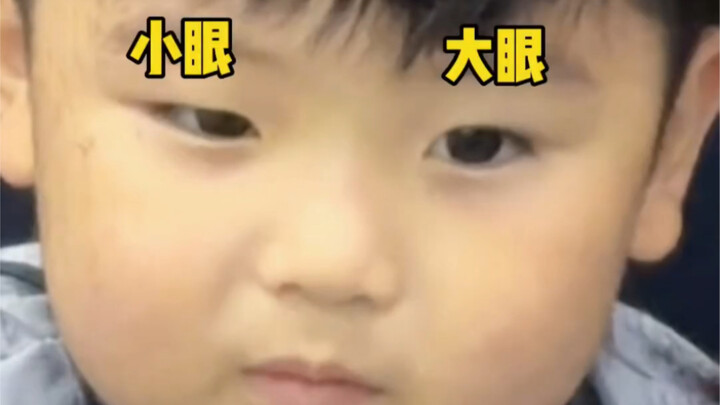 Thì ra bấy lâu nay chúng ta đã hiểu lầm bạn! Hóa ra lại phải cắt mí mắt!