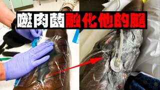 [Cắn vào chân] Một vết thương do bị cắn khi cố gắng ngăn cản một cuộc ẩu đả. Vi khuẩn ăn thịt ăn thị