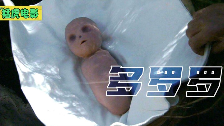 Seorang bayi laki-laki lahir tanpa kedua tangan dan kaki, serta tanpa mulut dan hidung; sang dukun m