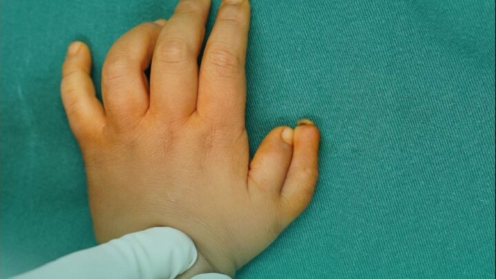 A Kazakh national traveled to Wuhan, China, for medical treatment, successfully preserving both the 