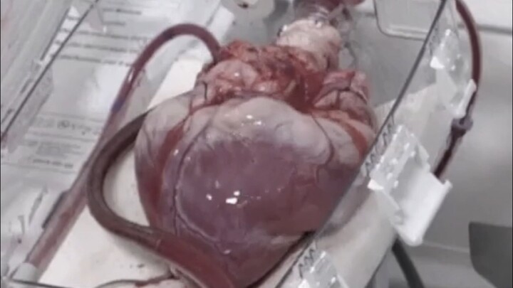 The human heart beats roughly 2.5 to 3 billion times over a lifetime—but what happens if, for some r