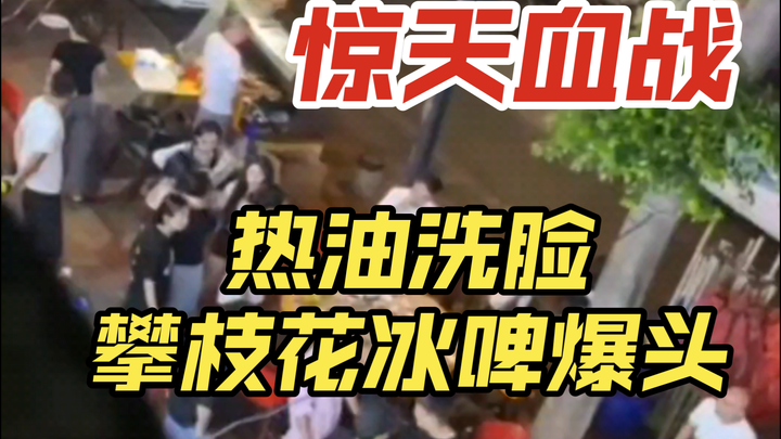 النسخة الوطنية 79، الحلقة الأكثر إيلامًا: غسل الوجه بالزيت الساخن، البيرة المثلجة للعناية بالبشرة، ض