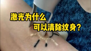 Why are tattoos so difficult to remove? How does laser tattoo removal work? #Science #Relief #Tattoo