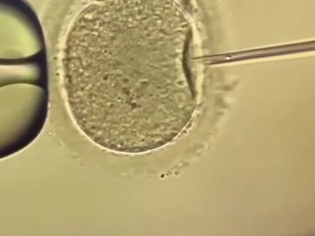 Intracytoplasmic sperm injection (ICSI)