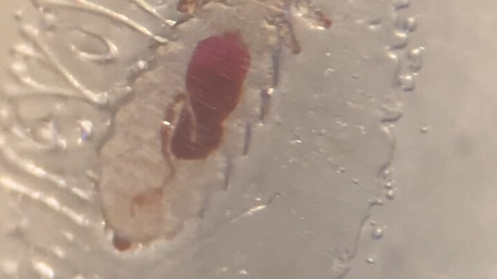 ขำตาย อาหารที่ซื้อมาเลี้ยงงูมีจุดแดงเล็กๆ อยู่บนหนูขาวเคลือบด้วยน้ำค้างแข็ง รู้สึกเหมือนเหาหนู เมื่อ