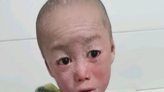Saat musim berubah menjadi dingin, tubuh mulai banyak mengelupas kulit, setiap hari harus berendam d