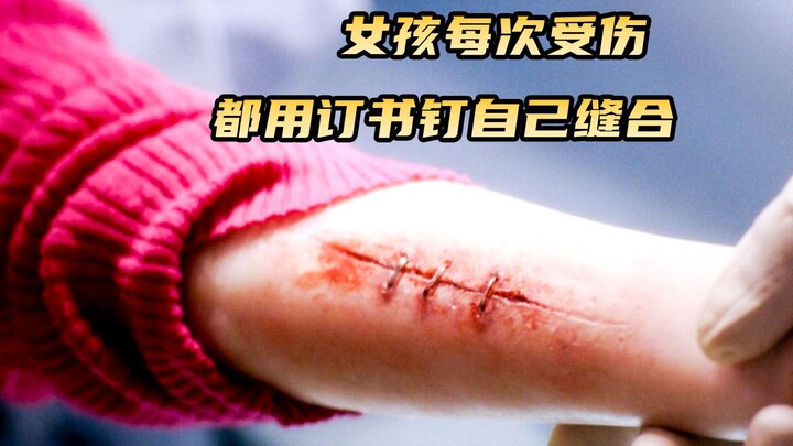 Mỗi lần bị thương, cô gái lại dùng ghim bấm để tự đâm mình.