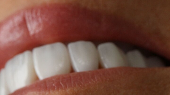lente dental