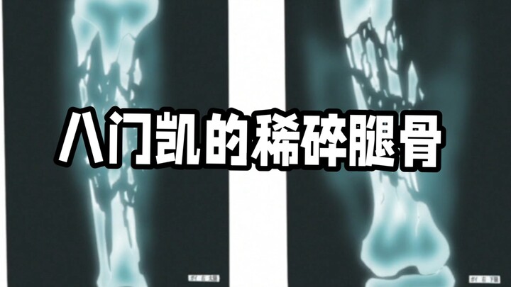 凯:“给我装个腿！我还能再开一次八门！”