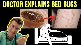 Doctor explains BED BUGS - including SYMPTOMS, TREATMENT AND PREVENTION ( +PHOTOS!)