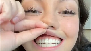 小姐姐口腔里没有一颗牙齿，戴上假牙后，瞬间年轻了三十岁