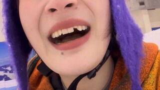 Although I lost half of my tooth, I gained happiness [囧]
