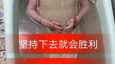 鱼鳞病太折磨人了