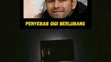 penyebab gigi berlubang