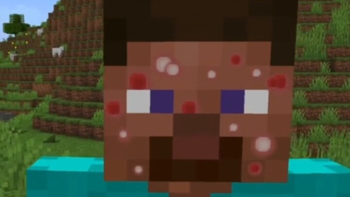 Minecraft: What happens when Steve gets pimples