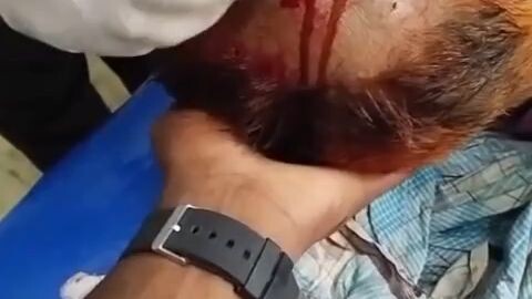 ফাঁস নিয়ে মারামারি করে মাতা পাটিয়ে দিয়েছে