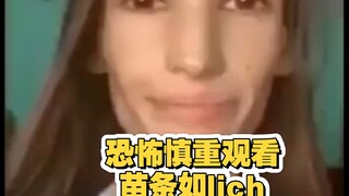 【ค่อนข้างน่ากลัว โปรดใช้ดุลยพินิจก่อนคลิก】ผอมแห้งอย่างรุนแรง โรคเบื่ออาหาร