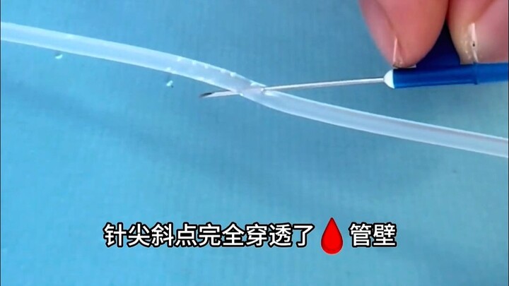 สามสาเหตุหลักที่ทำให้การให้สารน้ำทางหลอดเลือดดำล้มเหลว และวิธีแก้ไข