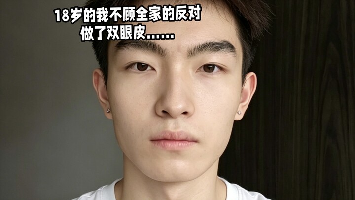 At 18, I got double eyelid surgery despite my family’s objections.