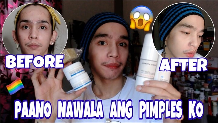 PAANO NGA BA NAWALA ANG AKING PIMPLES flawless first (Murang SkinCare) | beki lovers | gay couple