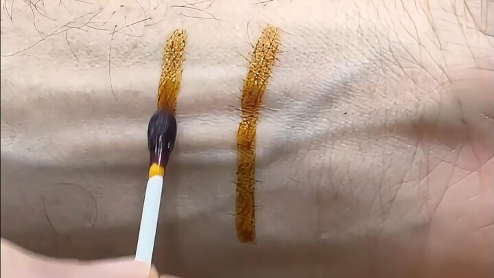 Why can povidone-iodine kill bacteria without harming the skin?