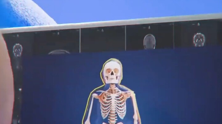 How Serious Are the Consequences of a Prank?