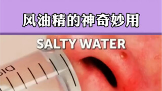 风油精的神奇妙用，快点收藏起来以后以防用得到！