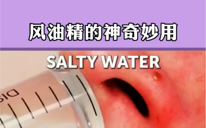 Amazing uses of Wind Oil—quickly save this for future reference!