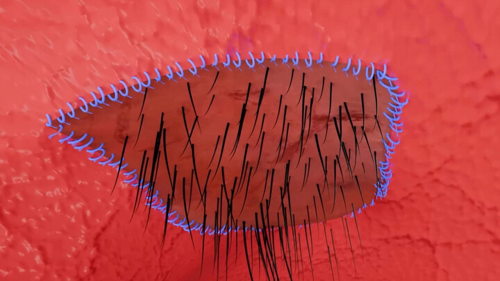 His throat is covered in hair.