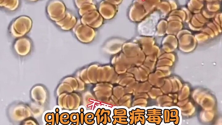 Who wouldn’t have a headache over this? Just hearing about it makes your head want to explode!