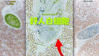 你的白细胞每天都在为你拼命🥹💗