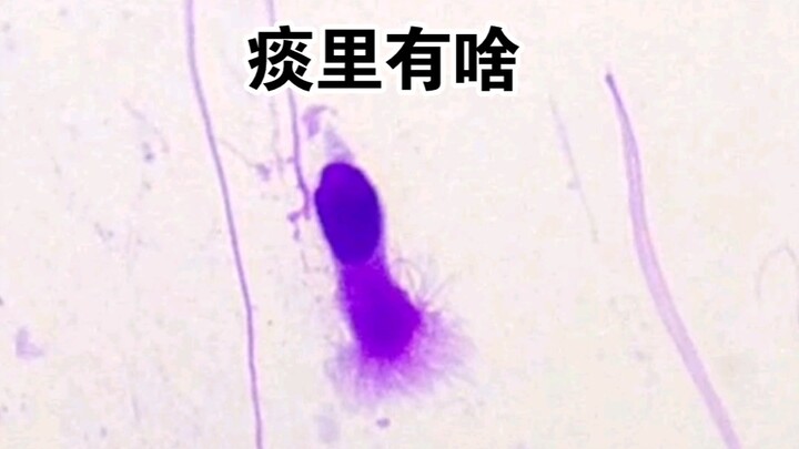 感冒了，痰里有什么？